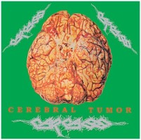 Carcass - Cerebral Tumor - Live In Dortmund 1990 - 2xLP